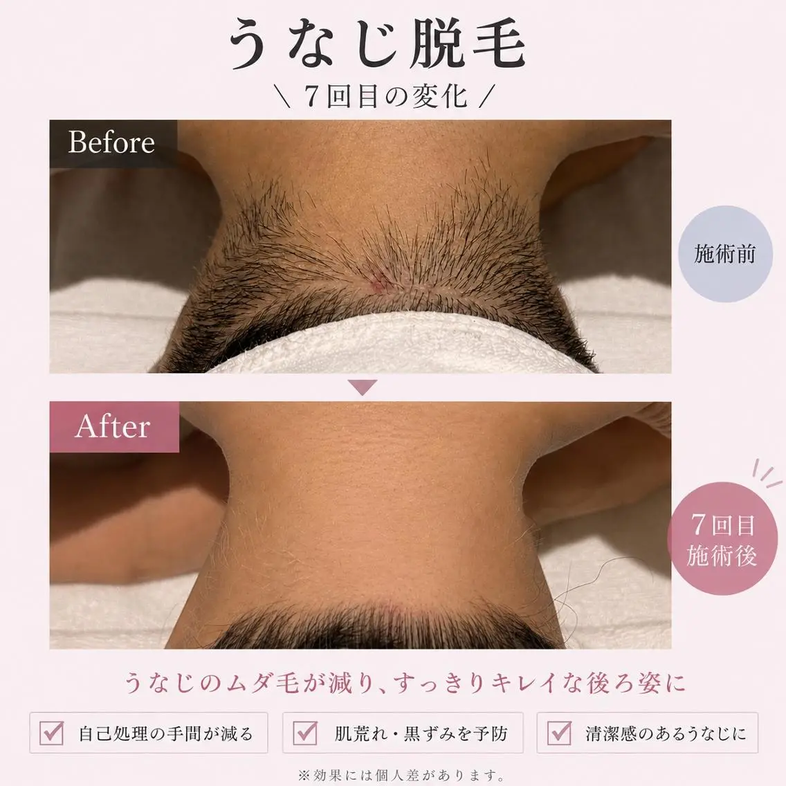 【メンズ脱毛・美肌】 SARA 恵比寿店のエステ・リラクイメージ