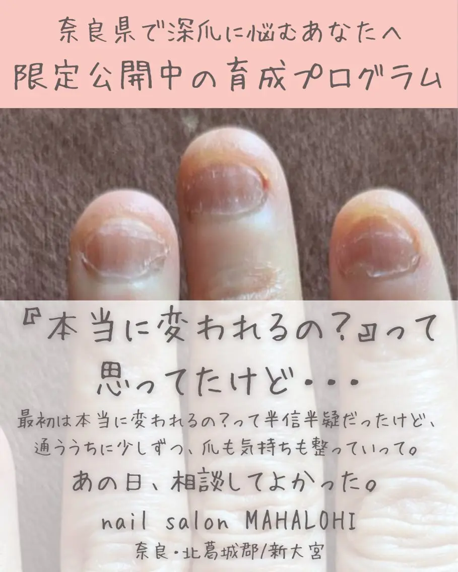 ネイル 深爪・自爪育成専門 MAHALOHIのネイルデザイン