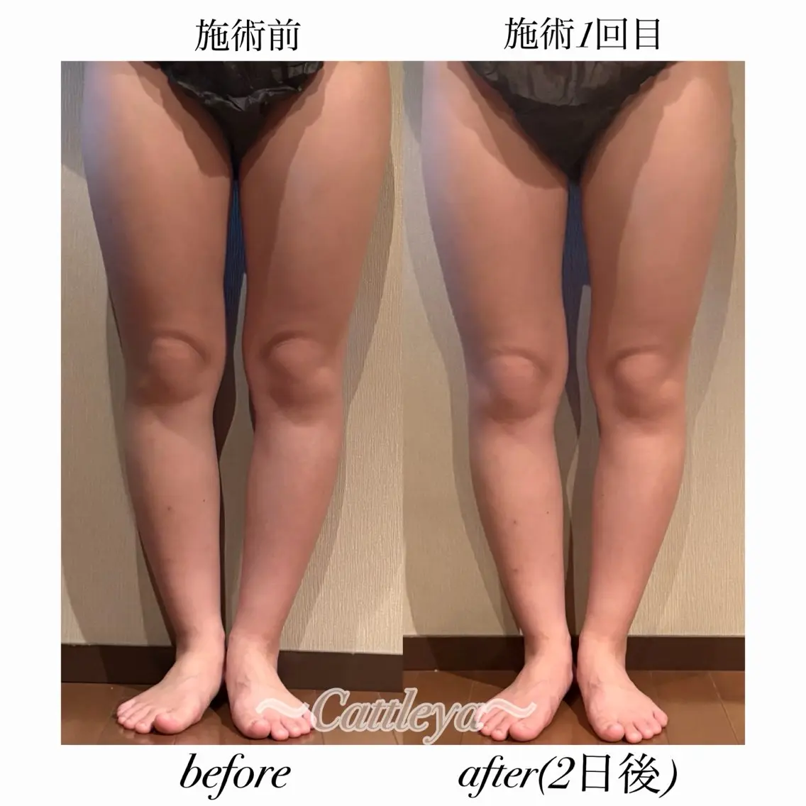 エステ Cattleya 中目黒のエステ・リラクイメージ