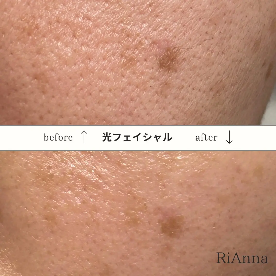 RuxuryNail /RiAnnaのネイルデザイン