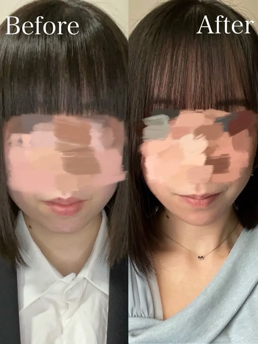 【小顔特化メニュー✨️】ドライヘッドスパ+耳マッサージ+小顔エムキューブ波¥4,400の写真