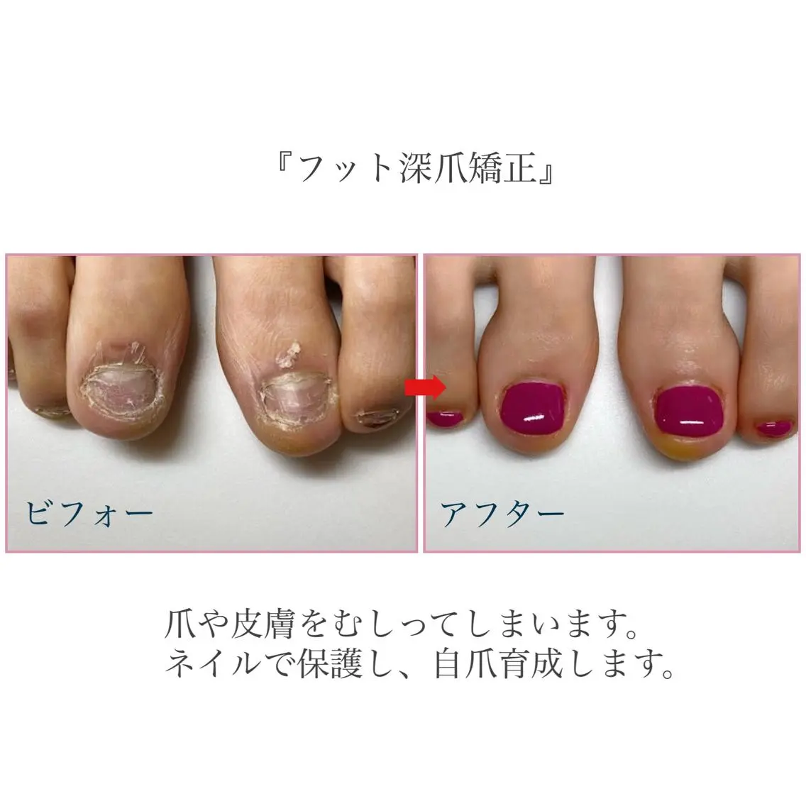 ネイル フットネイル ネイルサロン アリュームのネイルデザイン