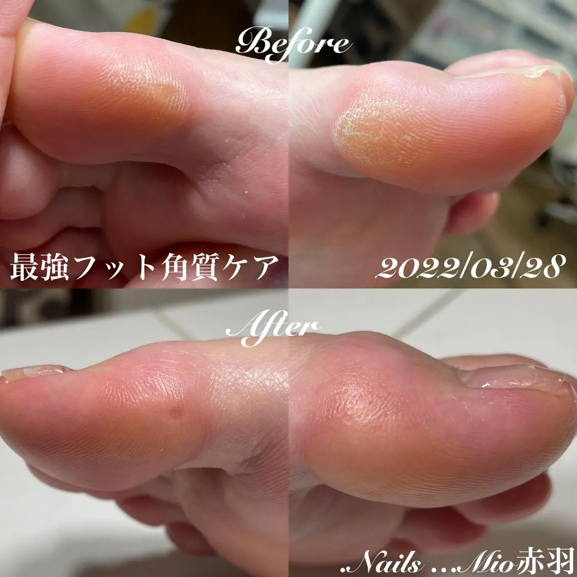 ネイル フットネイル .Nails Mio 赤羽西ネイルサロンのネイルデザイン