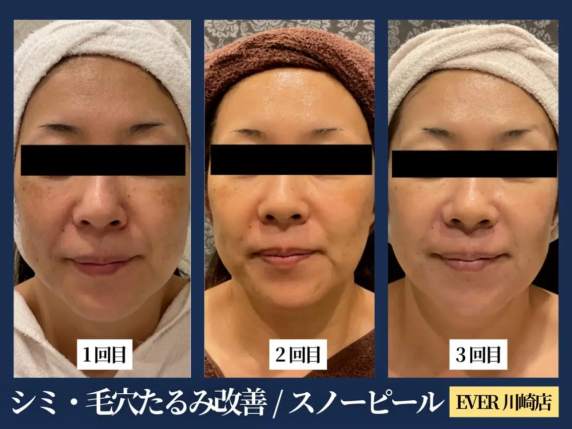 エヴァーグレース 川崎店のエステ・リラクイメージ