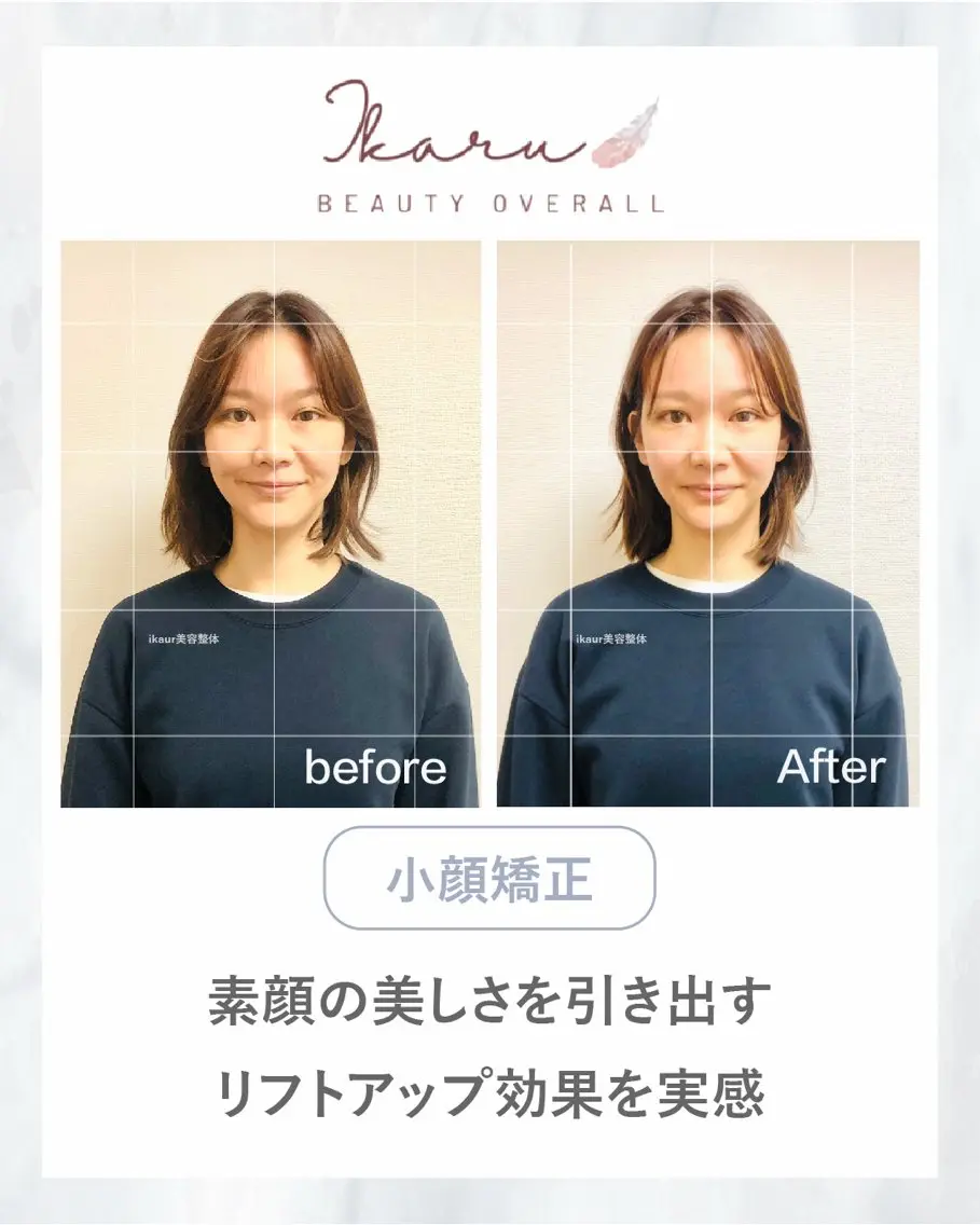 ikaru美容整体｜ イダのエステ・リラクイメージ