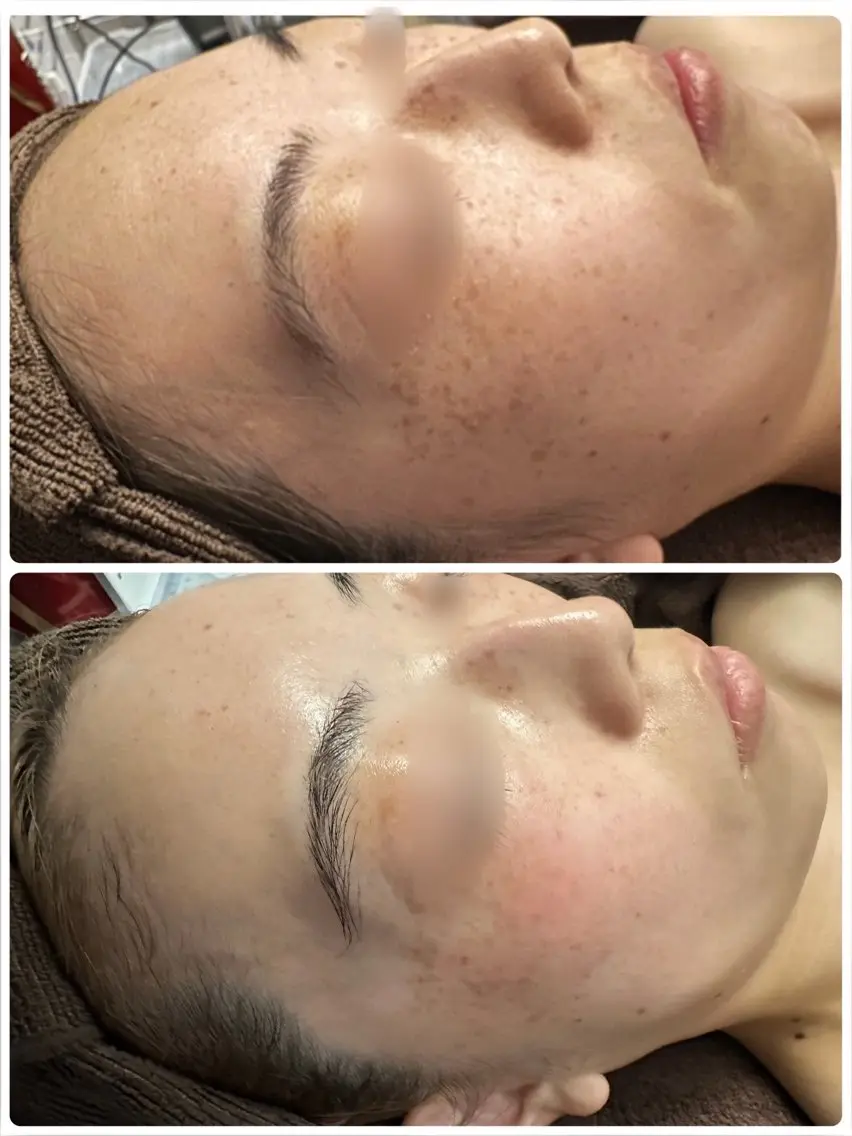 🥇肌再生スペシャル全てのお悩みに対応の写真