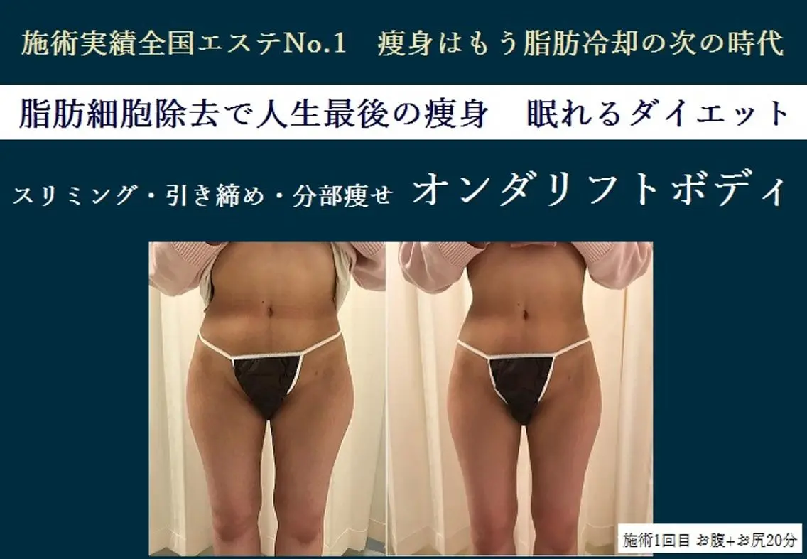 小顔&たるみ&痩身 オンダリフト♪ヒロコのエステ・リラクイメージ