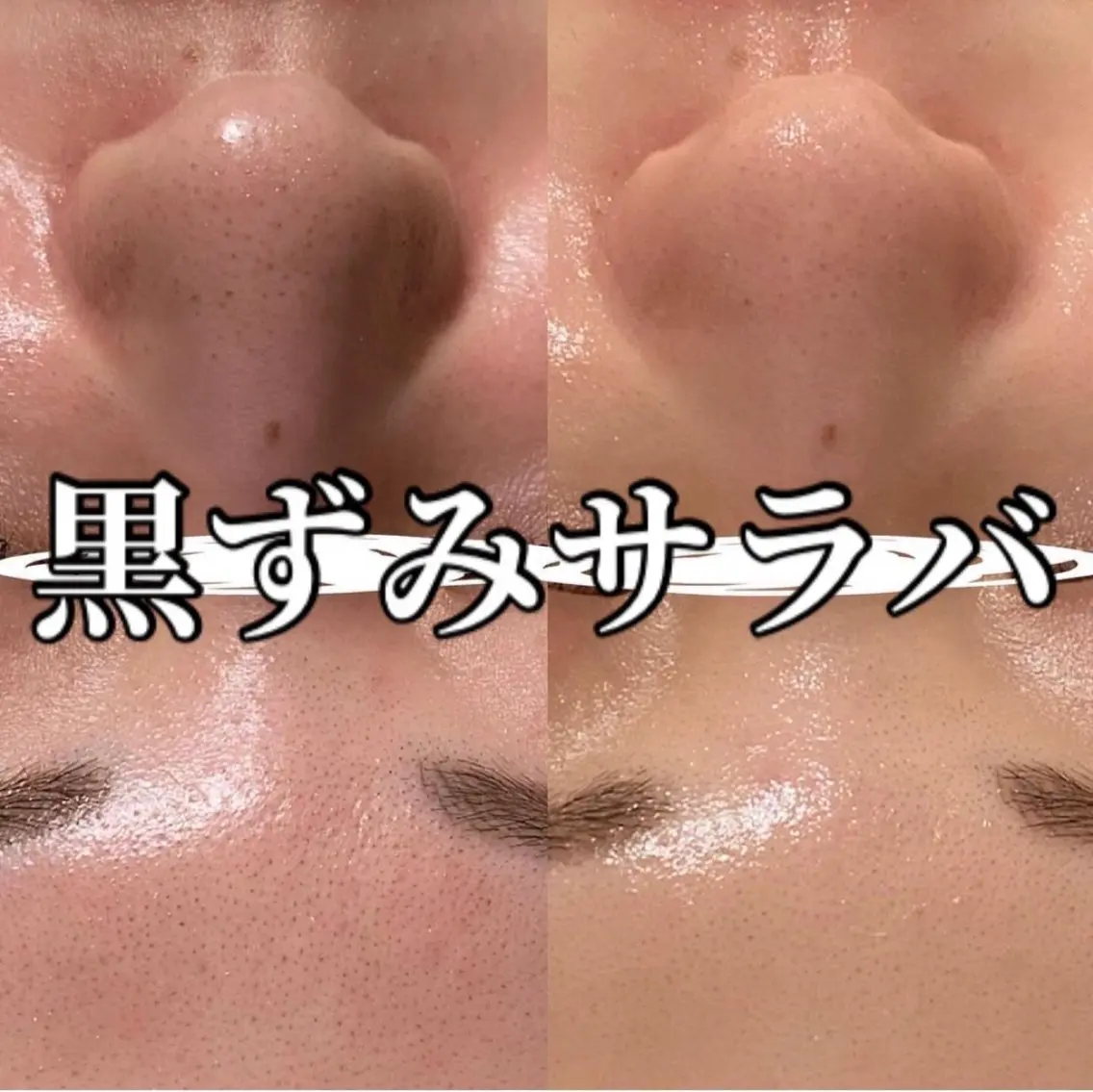 中目黒ハーブピーリン グ🌿ララピールのエステ・リラクイメージ