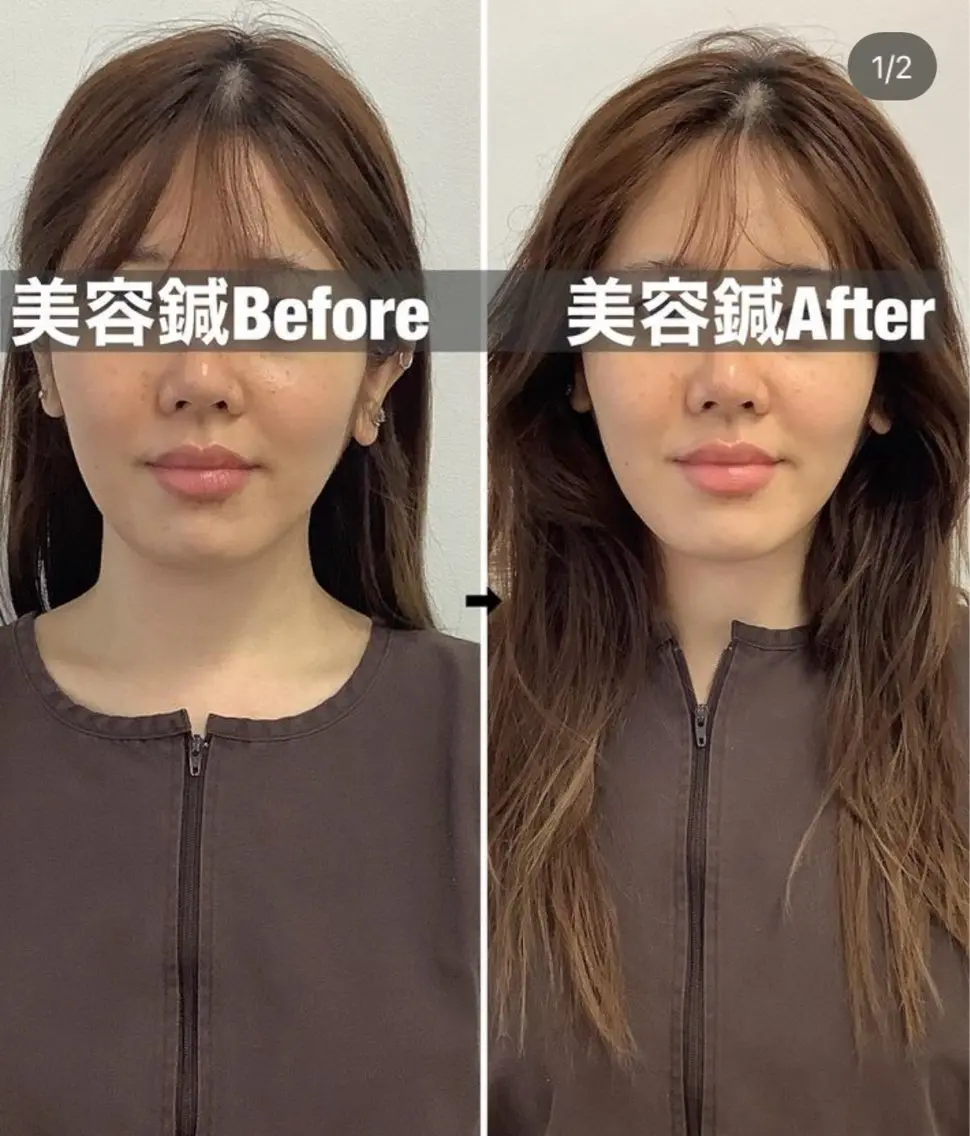エステ リラク 美容鍼灸×小顔整体♡ ハリサロンドオフ堺東のその他イメージ