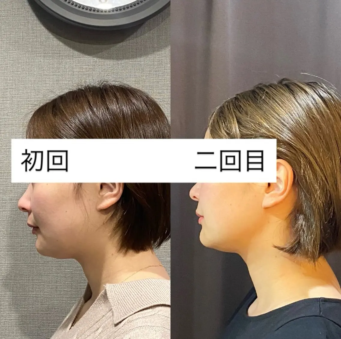 エステ 肌質改善専門 ハーブ /毛穴洗浄 リエイトのエステ・リラクイメージ
