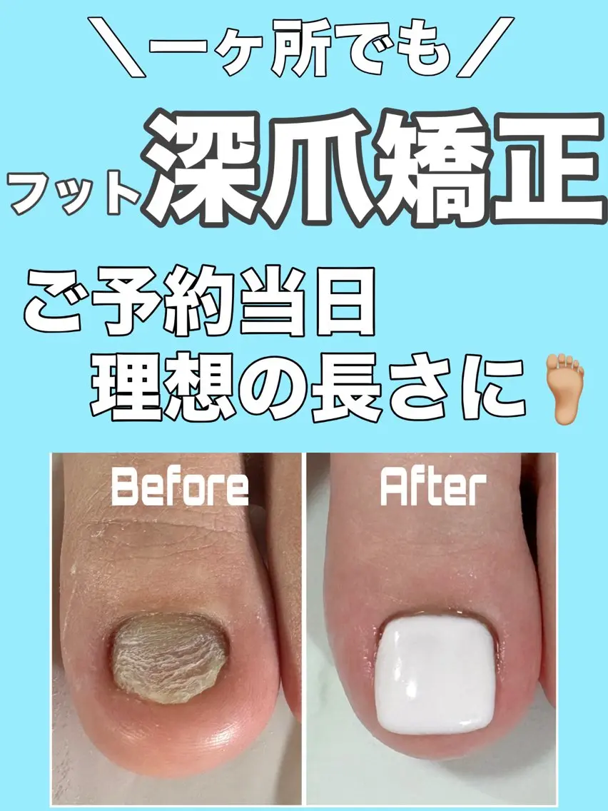 ネイル フットネイル nail salon petillantのネイルデザイン
