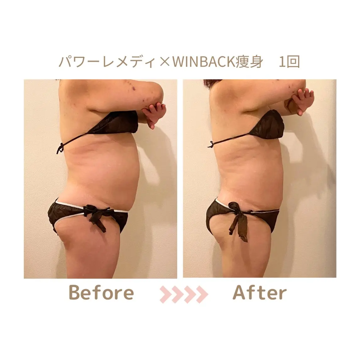 肌質改善×小顔サロン リトリト垣内のエステ・リラクイメージ