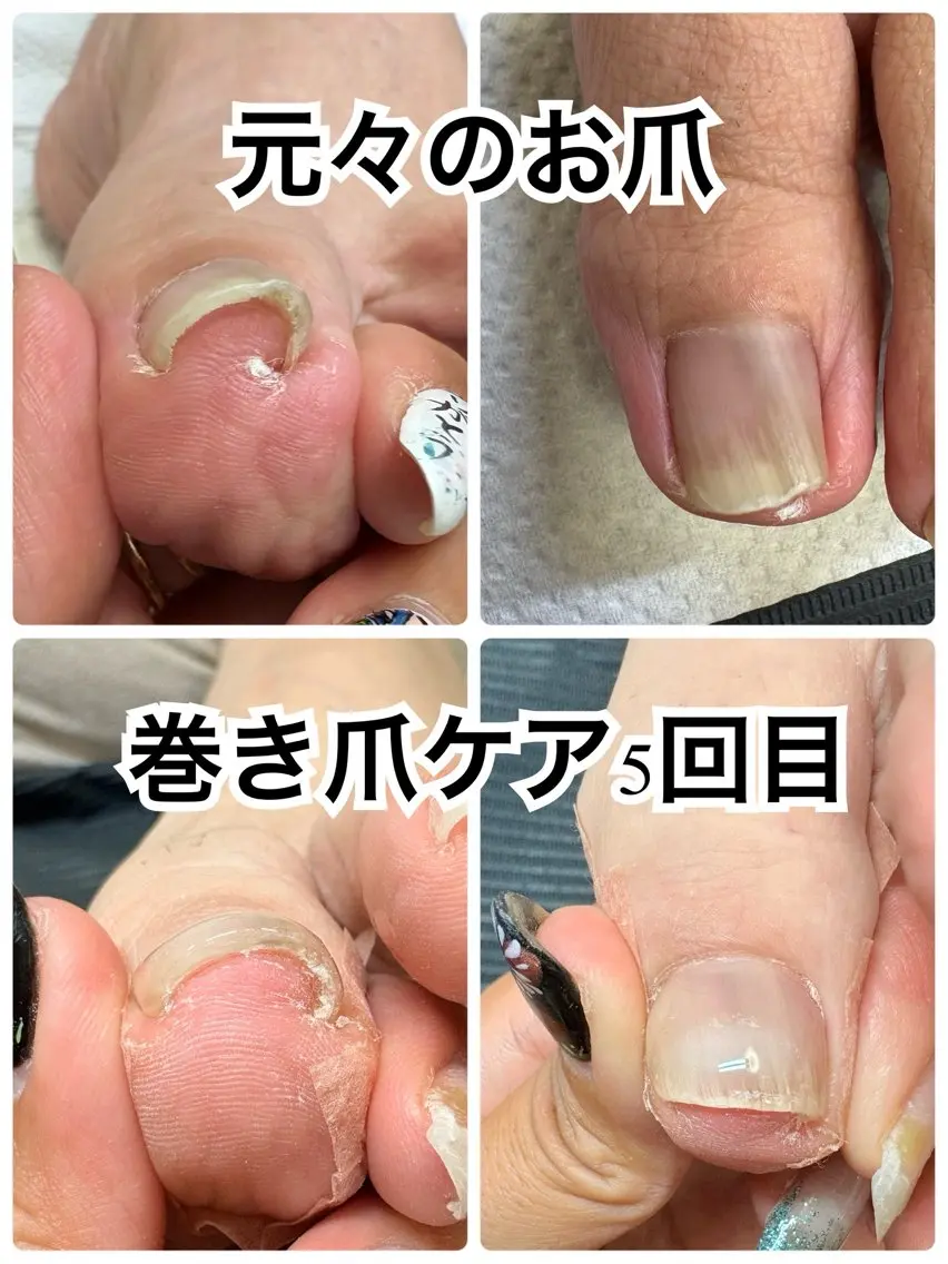 ネイル フットネイル -TOIRO- Eriのネイルデザイン