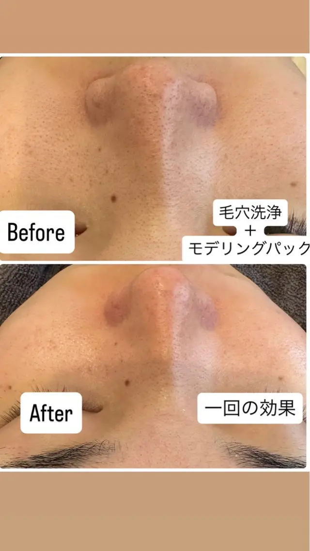 その他 ブリリエット 楠井のエステ・リラクイメージ