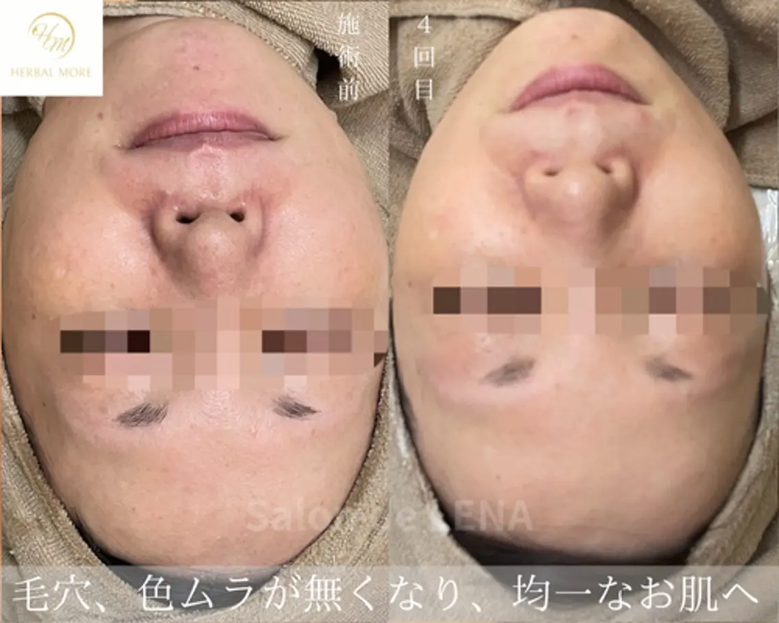 エステ ハーブピーリング専門 サロンドレナ平岡のエステ・リラクイメージ