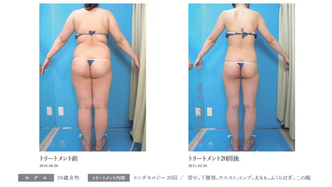 オレンジバナナ 新潟店のエステ・リラクイメージ