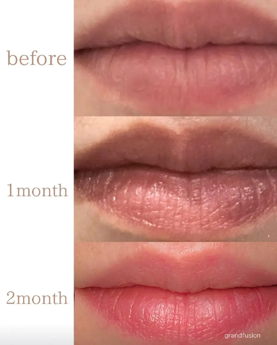 【話題のローマピンク✨】唇の黒ずみが本来のピンクに変身🎵アフタークリーム合計3本付き✨の写真