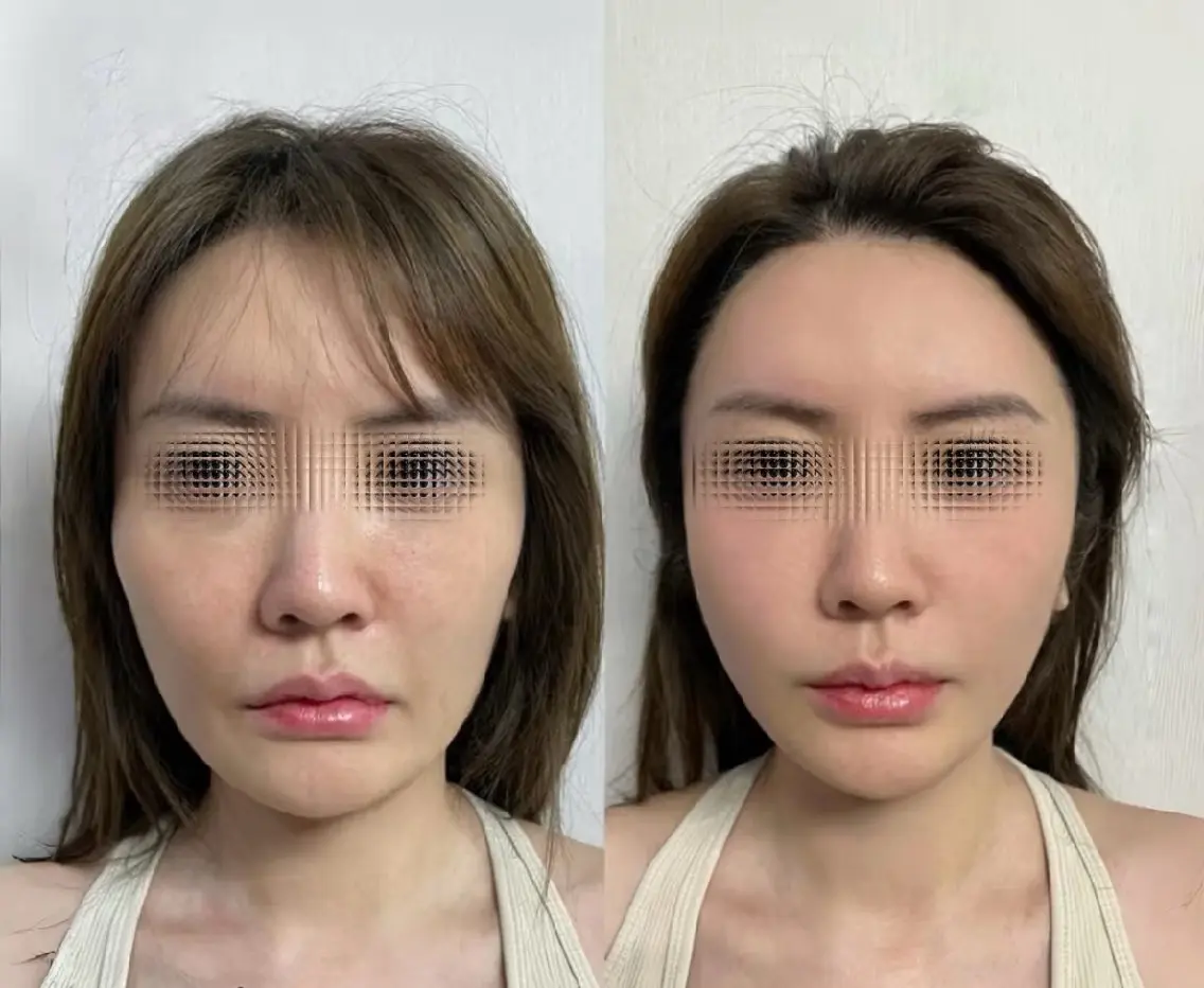 アイブロウ 眉毛ワックス脱毛 aliaハーブ水光店 エステティシャン募集のエステ・リラクイメージ