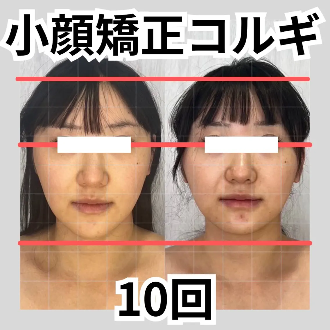 第一印象専門サロン ADISEのエステ・リラクイメージ