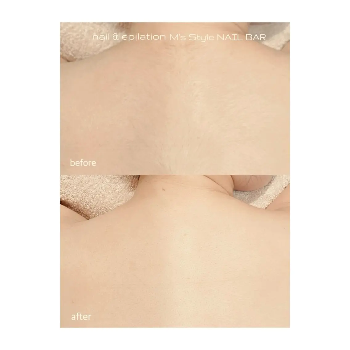 脱毛 M's Style NAIL BARのネイルデザイン