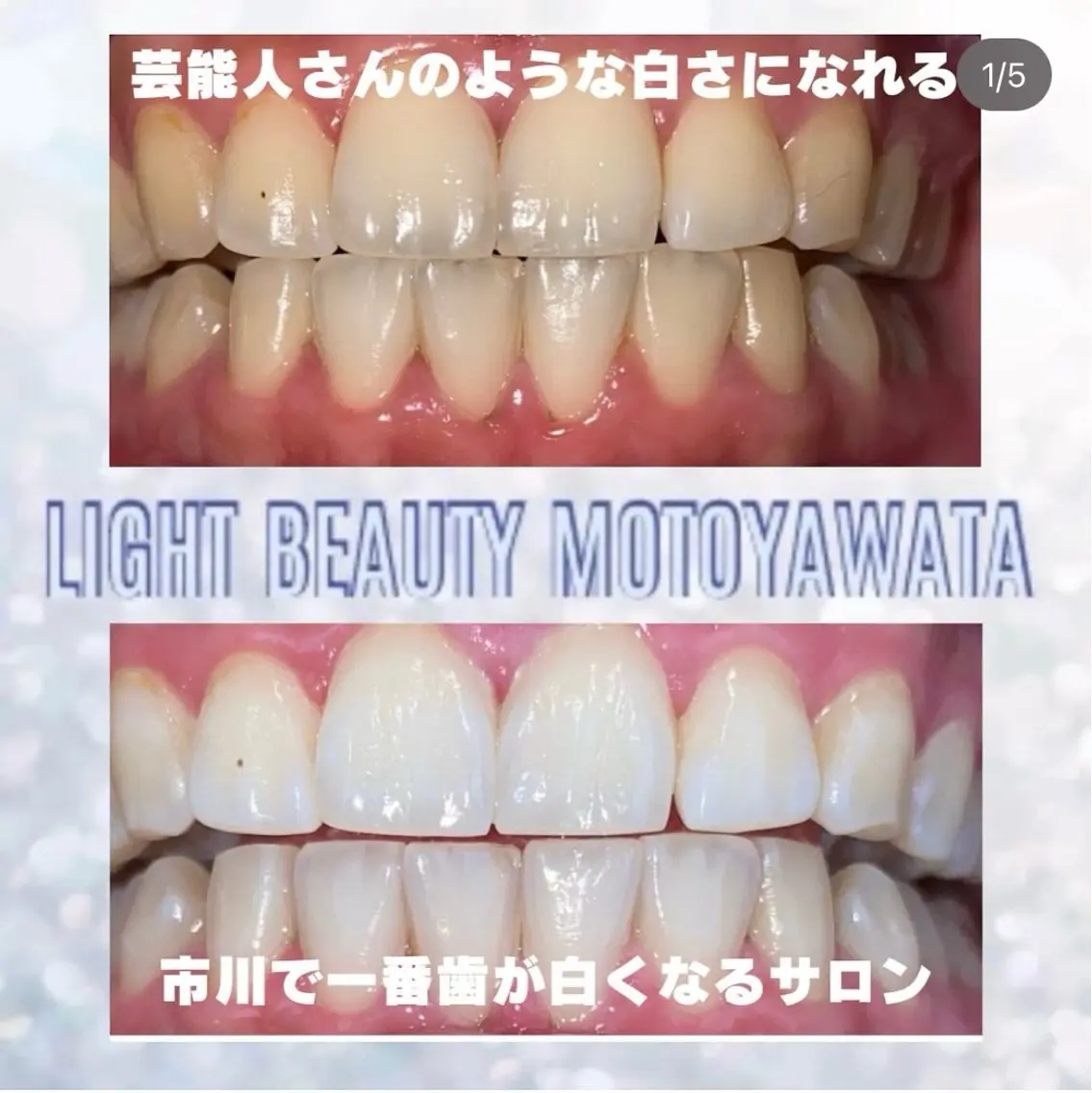 その他 五十嵐 蓮のその他イメージ
