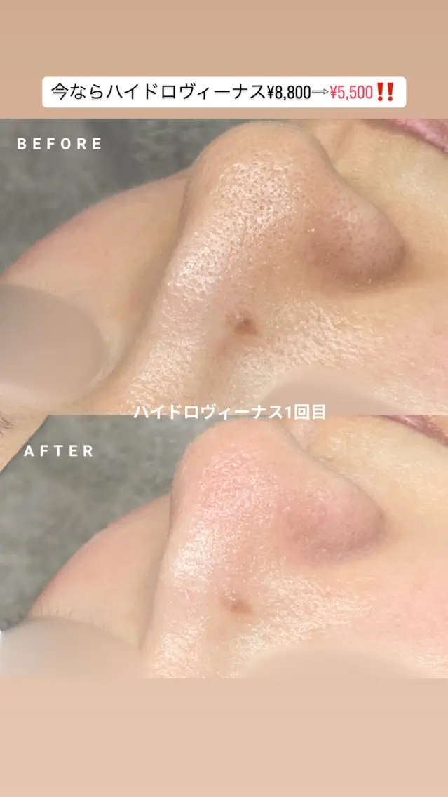 エステ cocofleur 美容看護師監修サロンのエステ・リラクイメージ