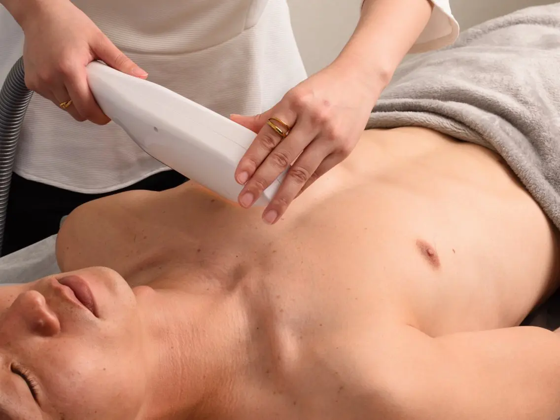 【火・水曜限定🔥】チクチク卒業!お手入れ楽したい方★メンズ★全身脱毛脱毛(顔VIO込)の写真