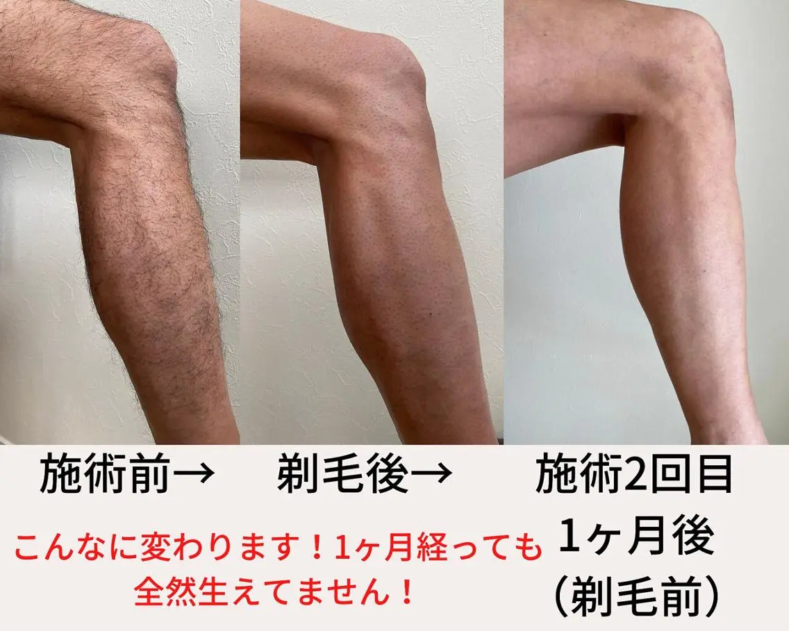 メンズ VANISH たやがきのエステ・リラクイメージ