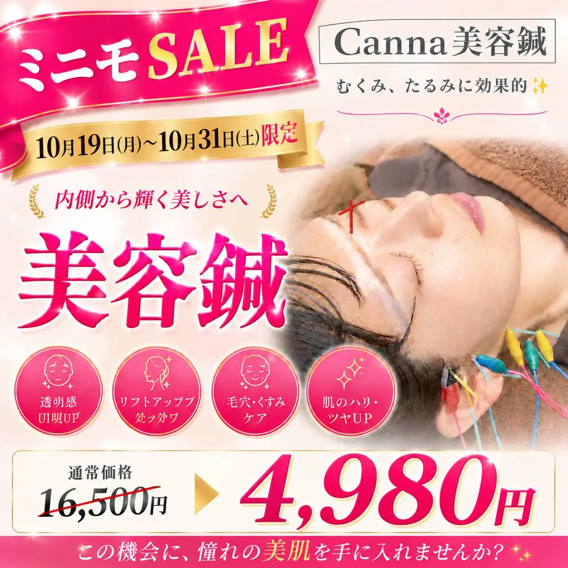 ミニモSALE!【人気No.2 】【浮腫み/肩こり/くすみ】90分⭐️美容鍼(顔鍼+身体鍼+フェイシャルマッサージ)の写真