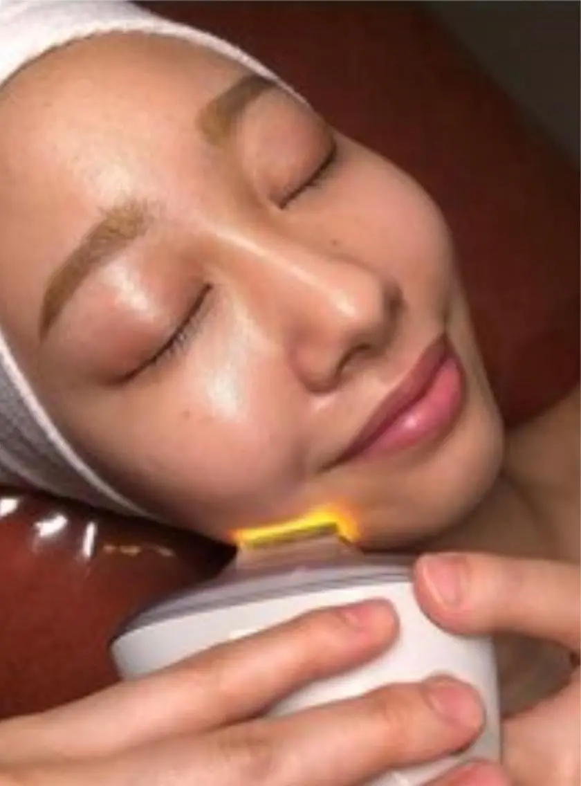シミケアモニター様募集！【IPLフォト美顔70分16,500円⇒¥5.500】の写真