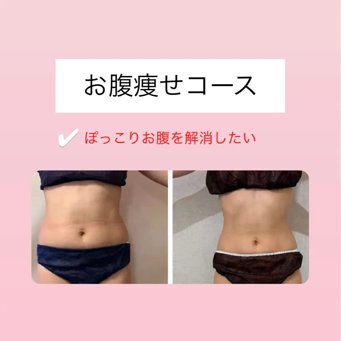 その他 Raviy 【痩身専門・肌管理】のエステ・リラクイメージ