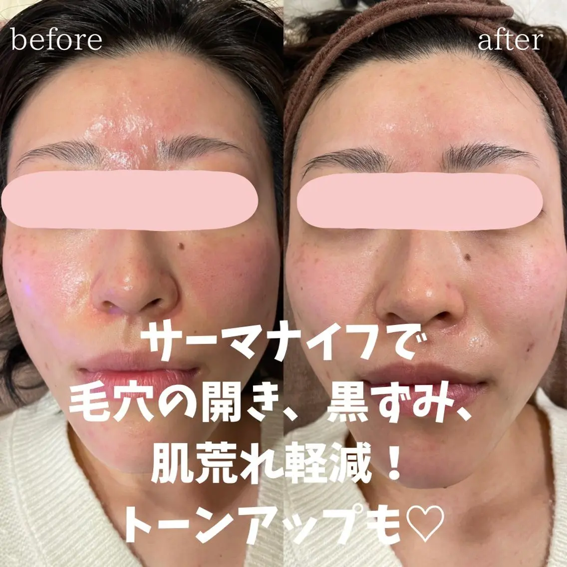 mish eyebrowのエステ・リラクイメージ