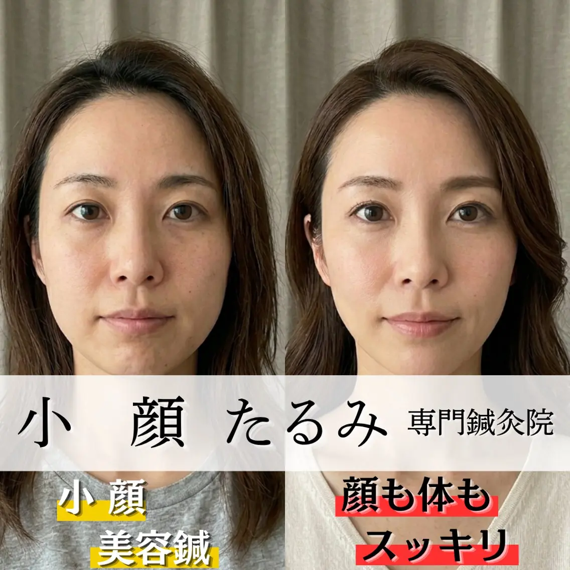 小顔・たるみ専門 DAZZLEのエステ・リラクイメージ
