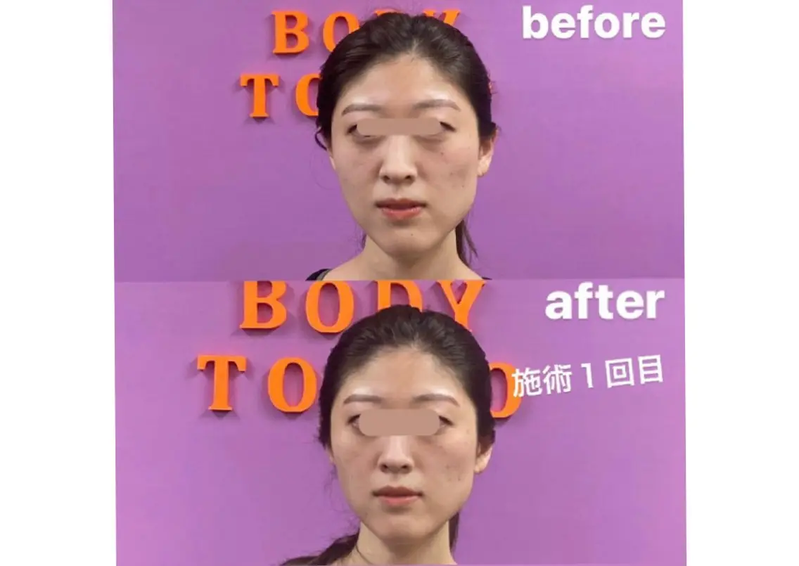 メンズ エステ リラク 美容整体 takahashiのその他イメージ