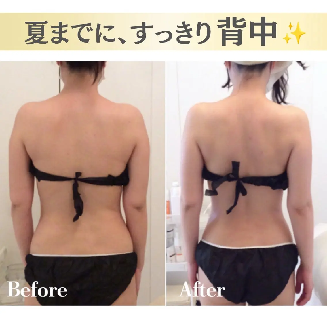 🉐【6月限定40%OFF】夏前お試し痩身✨60分×3回コースの写真