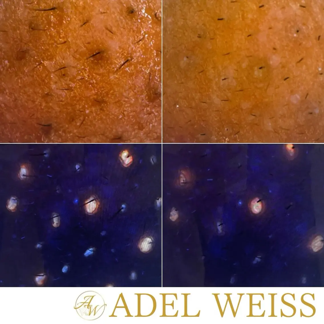 エステ リラク ADEL WEISS 脱毛＆毛穴＆リンパのその他イメージ