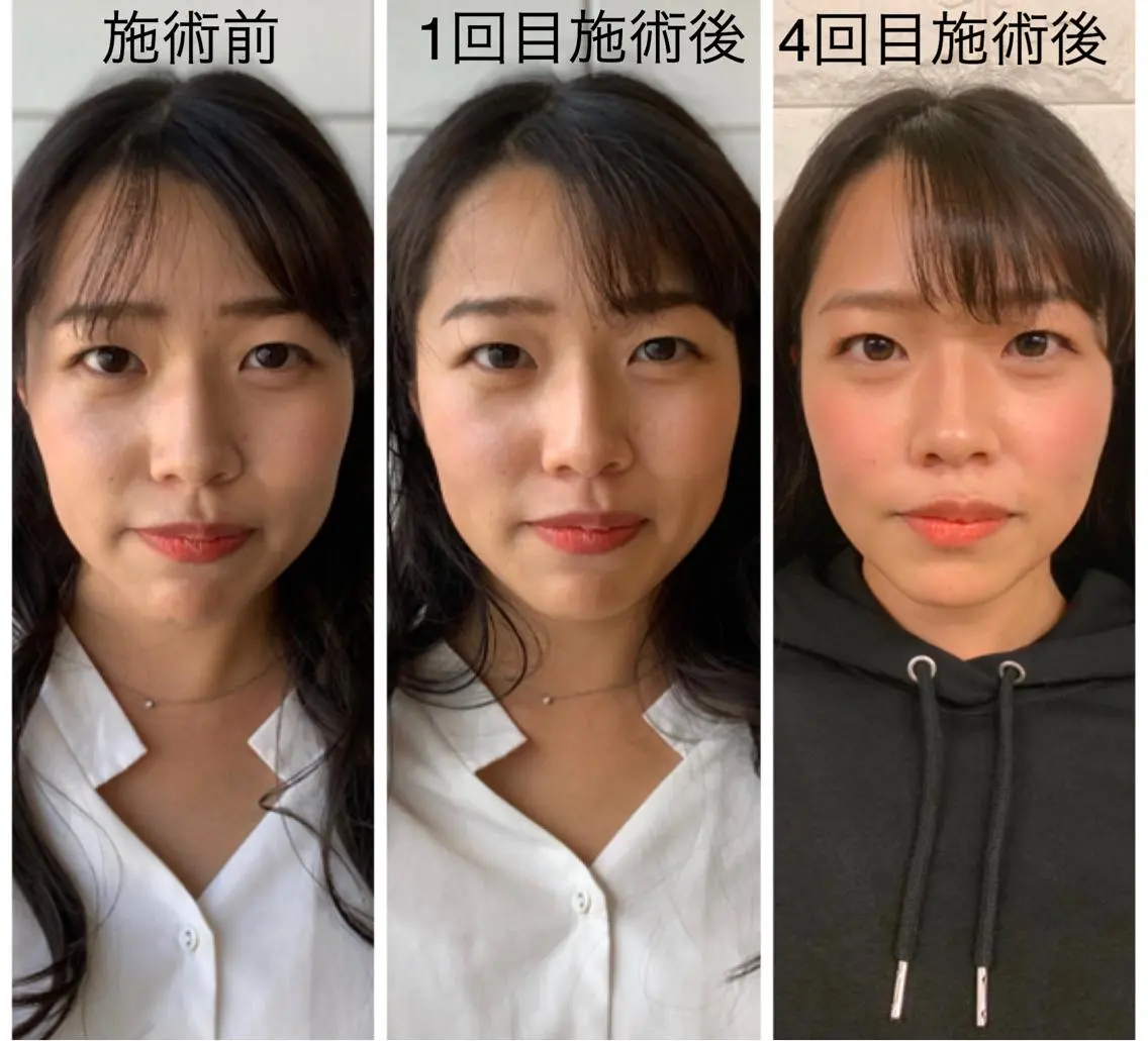 美容鍼 IKEZAKIのエステ・リラクイメージ