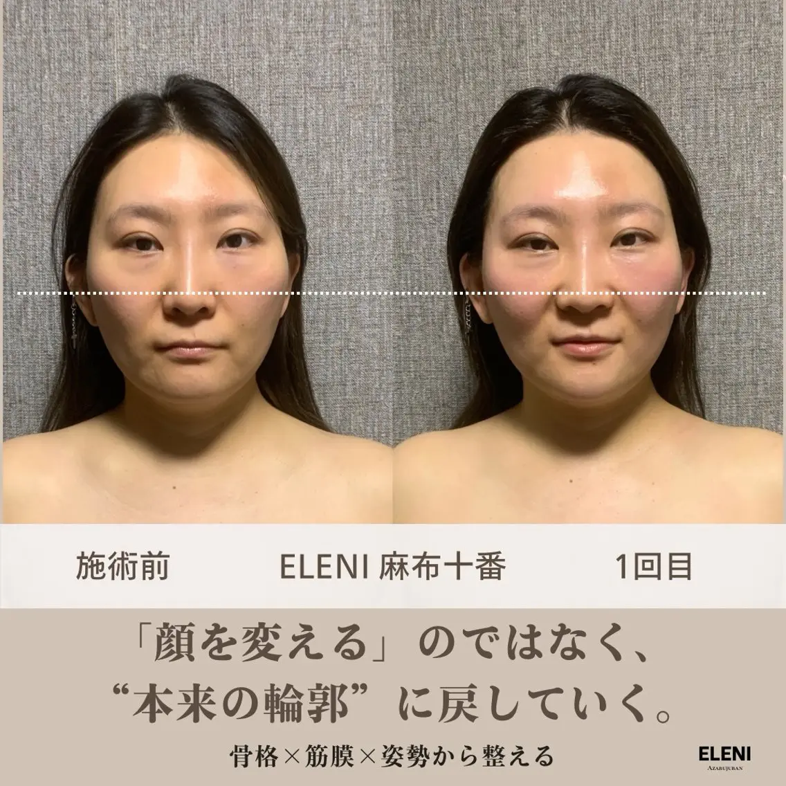 麻布十番小顔コルギ 姿勢矯正リアン💗のエステ・リラクイメージ