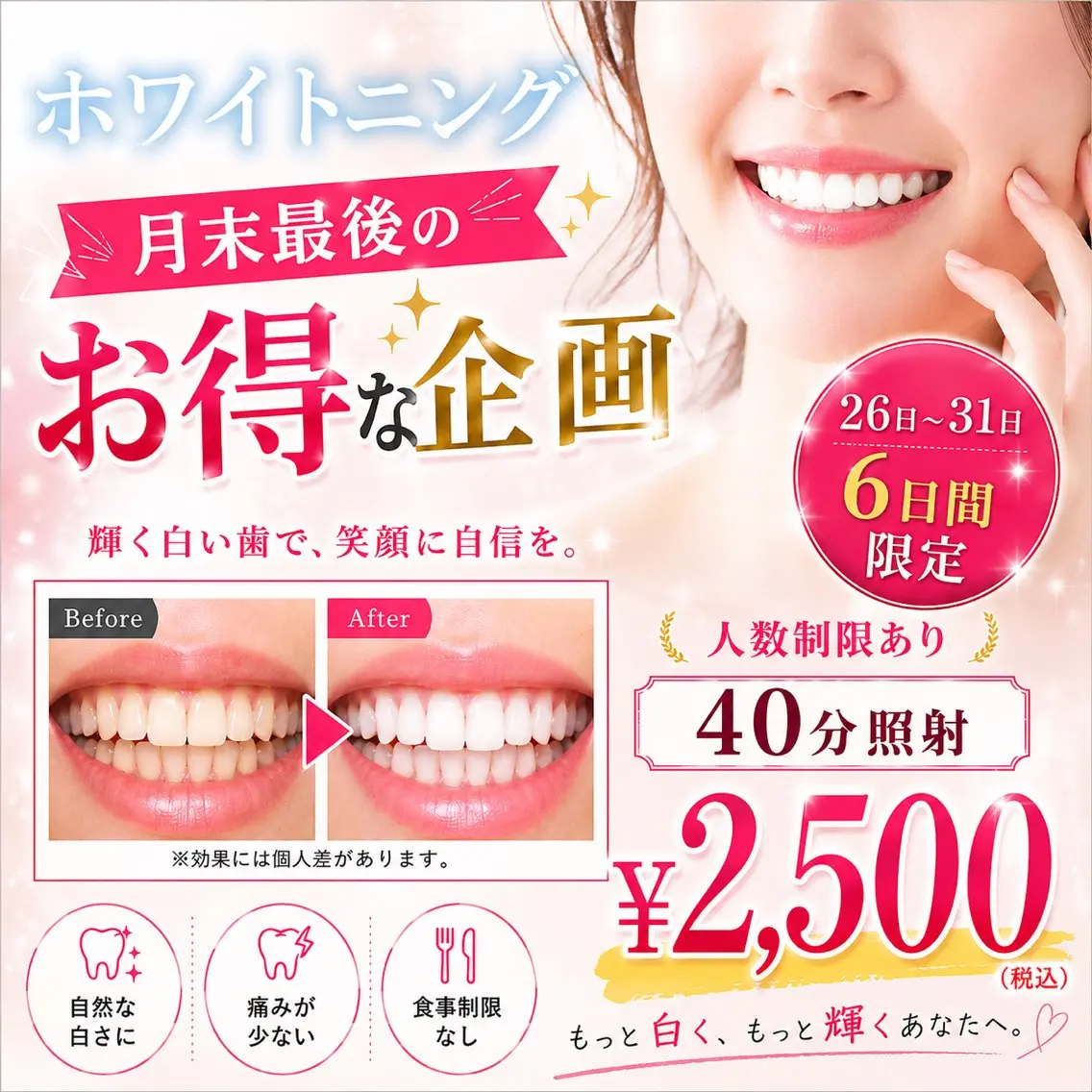 8月ラスト6日間限定!今月の締めくくりに是非☆1回のホワイトニングでも効果実感!人数制限あり・なくなり次第終了!の写真