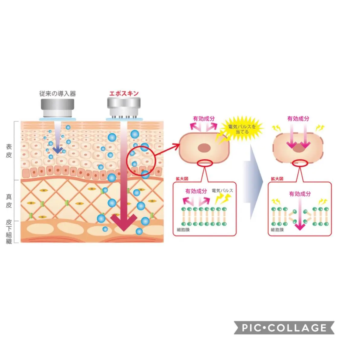 ニキビ、くすみでお悩みの方❗️乳酸ピーリング➕「VC20導入」エレクトロポレーション美白コース✨の写真