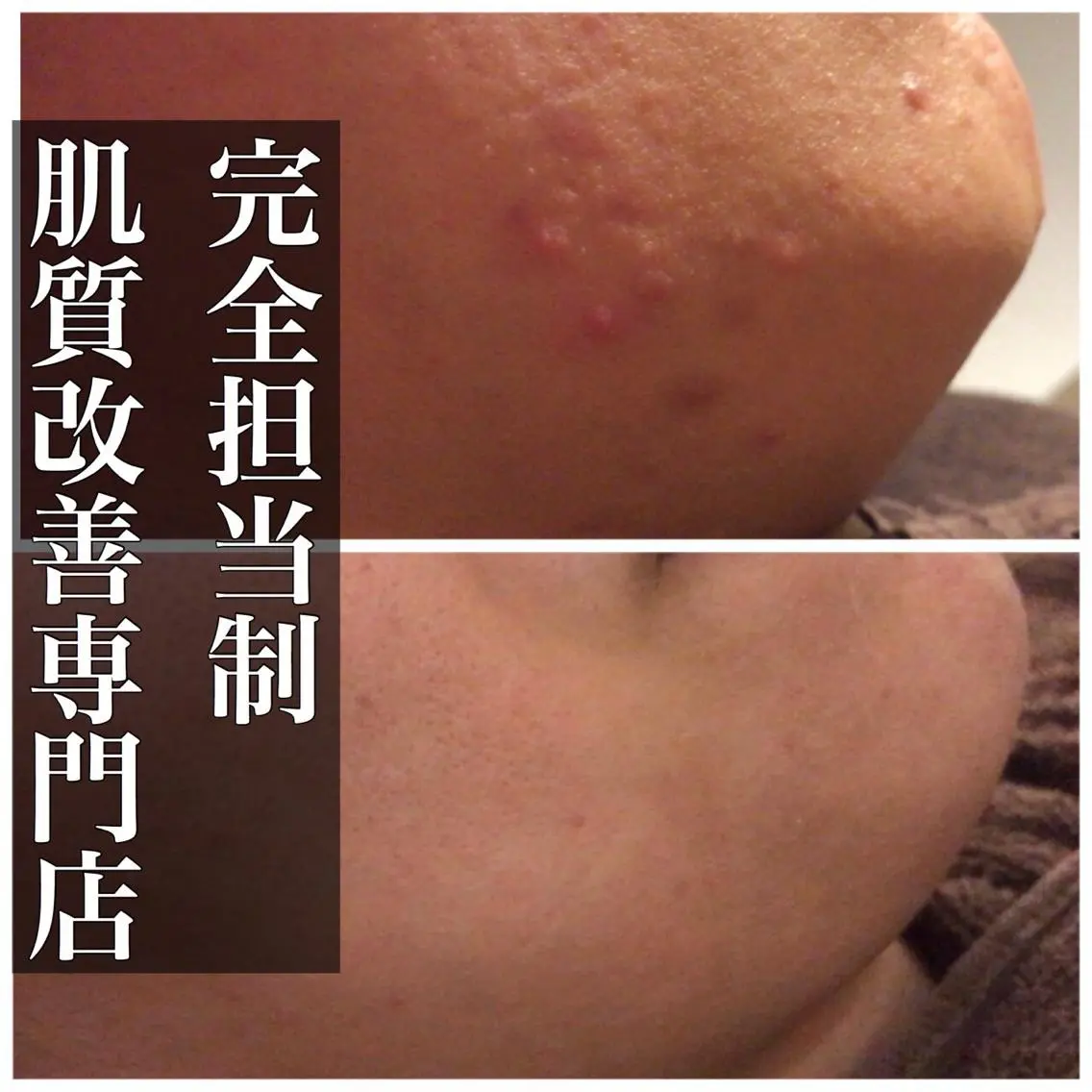 ミディアム カラー パーマ ヘアアレンジ メンズ キッズ ネイル マツエク・マツパ エステ リラク ニキビ・肌質改善専門 ♡人生が変わるサロンのエステ・リラクイメージ