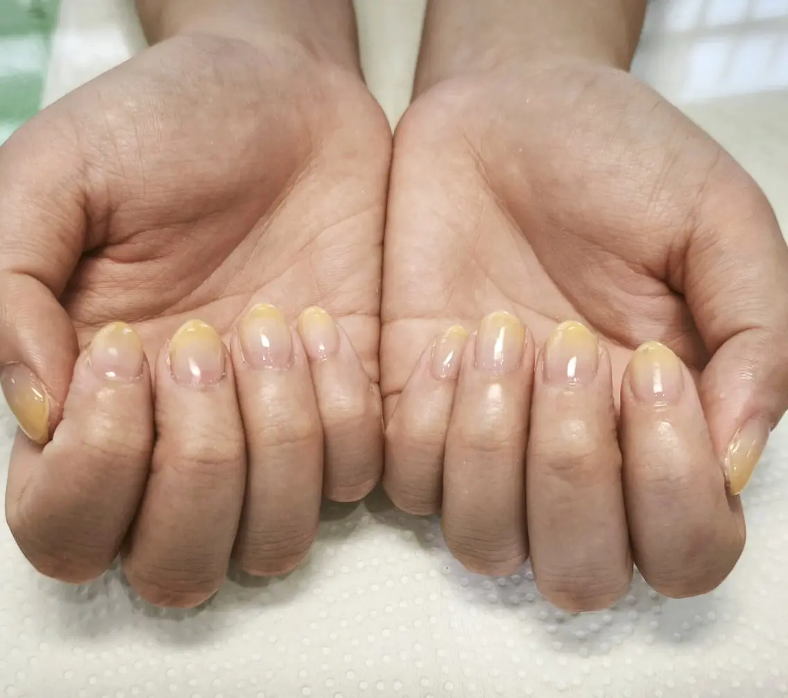 ネイル 古賀 倭子のネイルデザイン