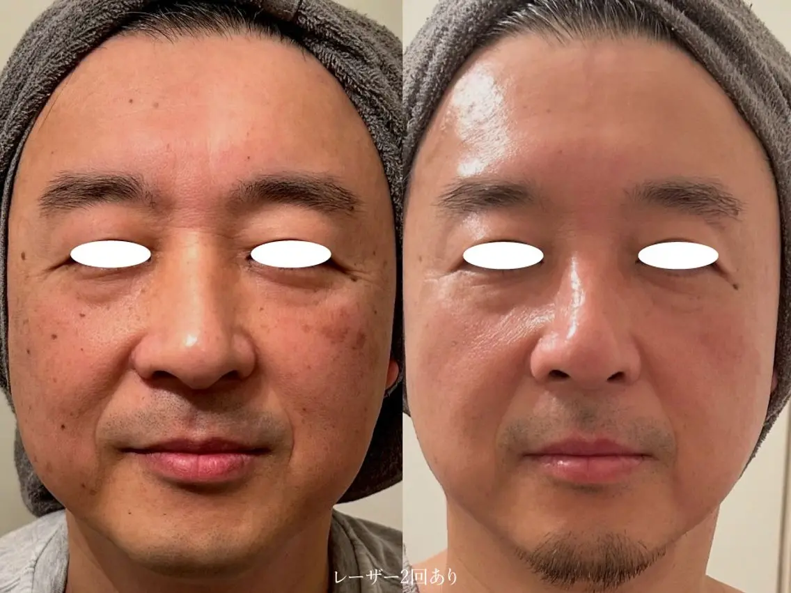 エステ Luu HANARE 和モダンサロンのその他イメージ
