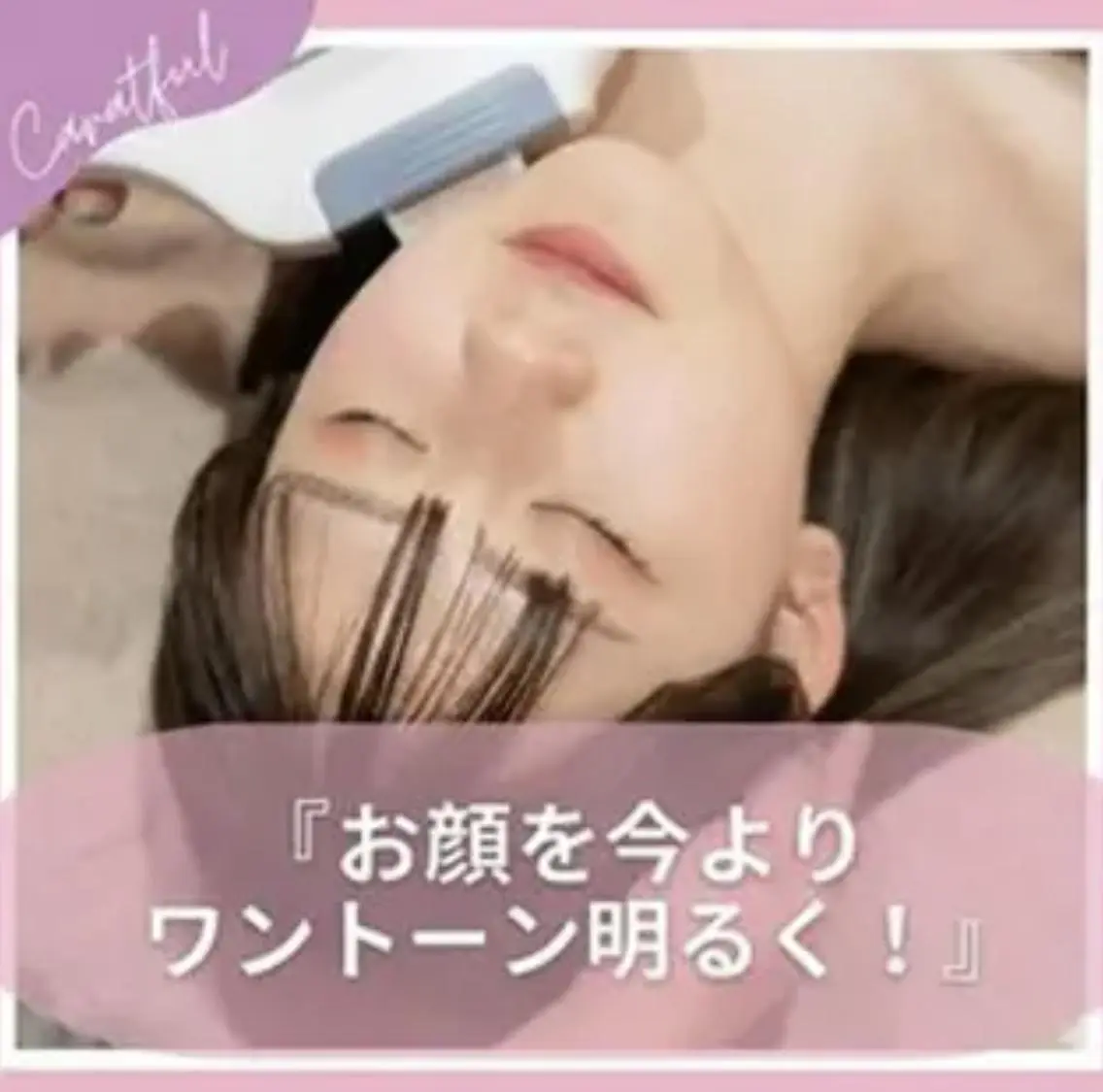 【担当スタッフ限定】化粧ノリUP♪顔&うなじ脱毛の写真