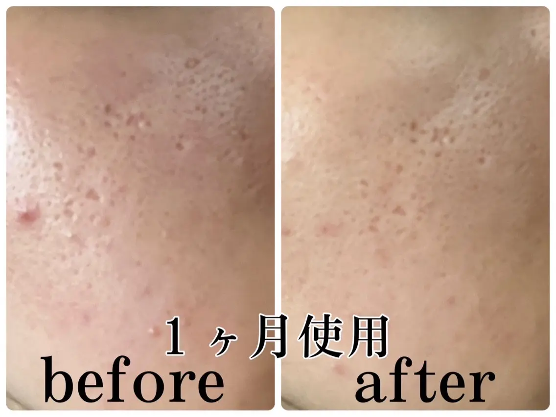 POLA The Beauty印場店のエステ・リラクイメージ