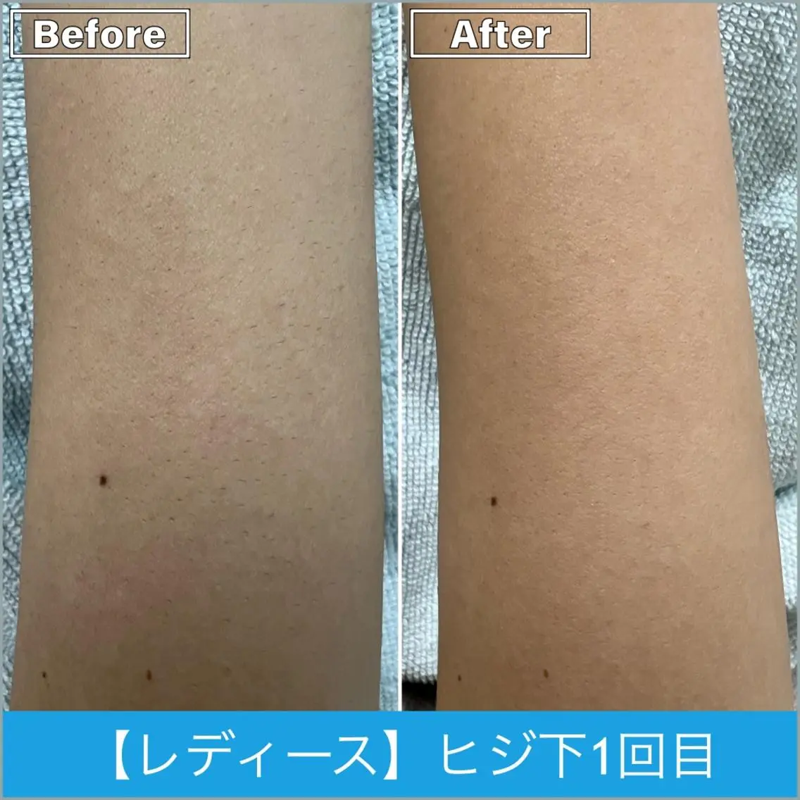 脱毛 プライベートサロン シャルムのその他イメージ
