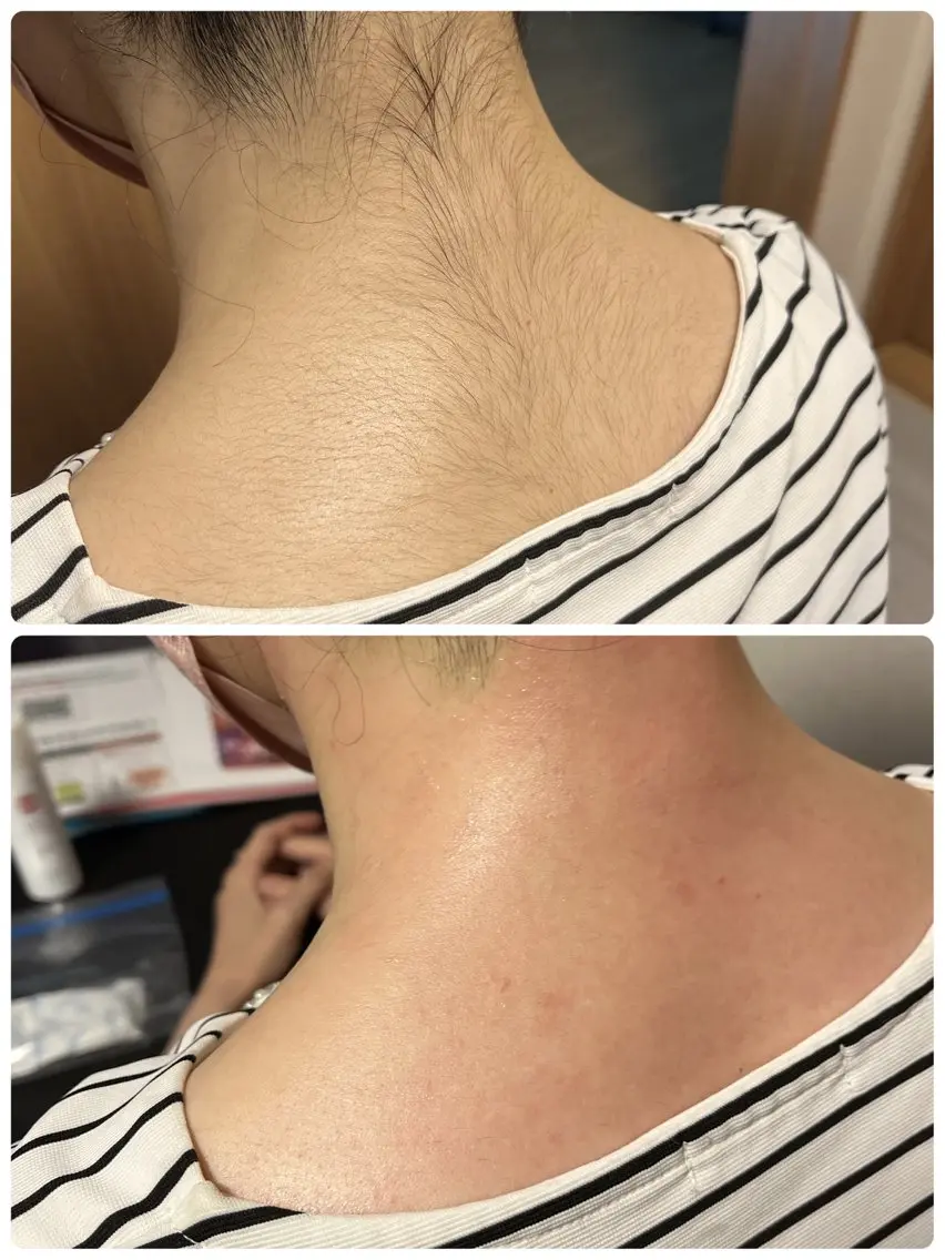 脱毛 Private SalonVinosのエステ・リラクイメージ