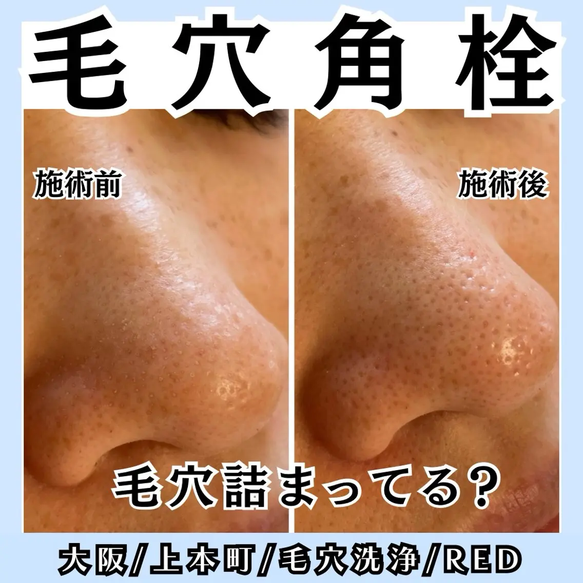 オンダリフト小顔・ ワックス脱毛×光脱毛のエステ・リラクイメージ