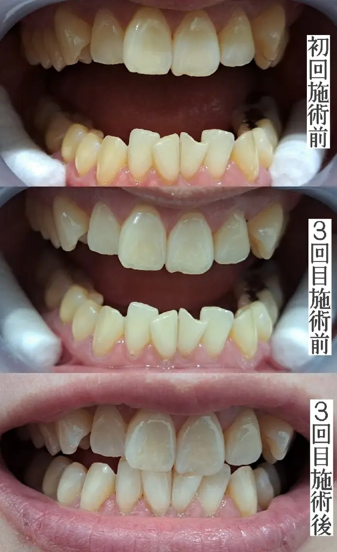 エステサロン LYSH愛名のエステ・リラクイメージ