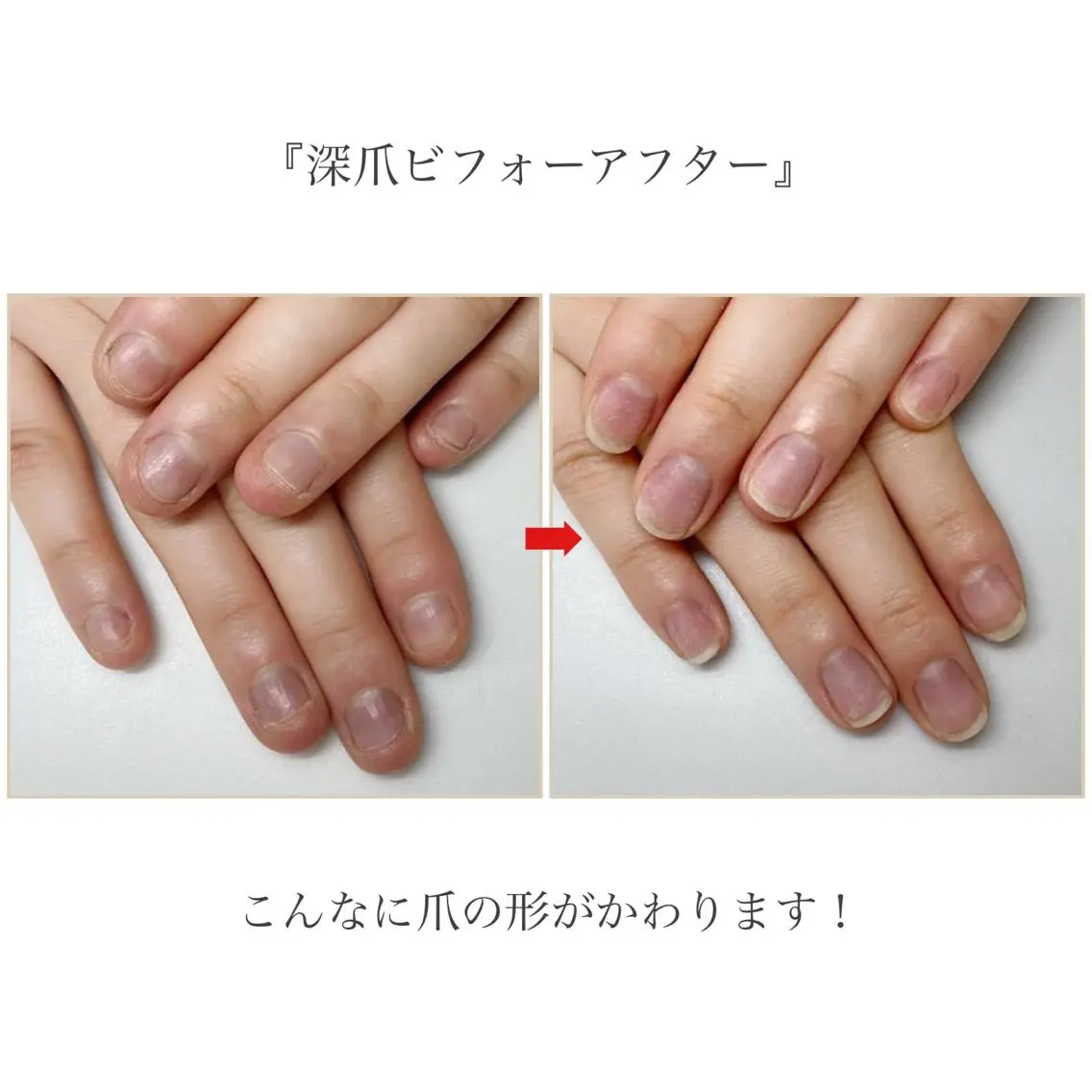 ネイル ネイルサロン アリュームのネイルデザイン
